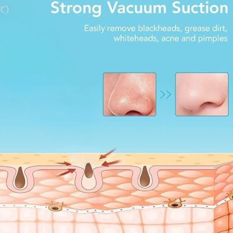 Rechargeable Blackhead Remover Vacuum Cleaner | Model FPLS-001 | Deep Pore Cleansing & Microdermabrasion Device - Image 7