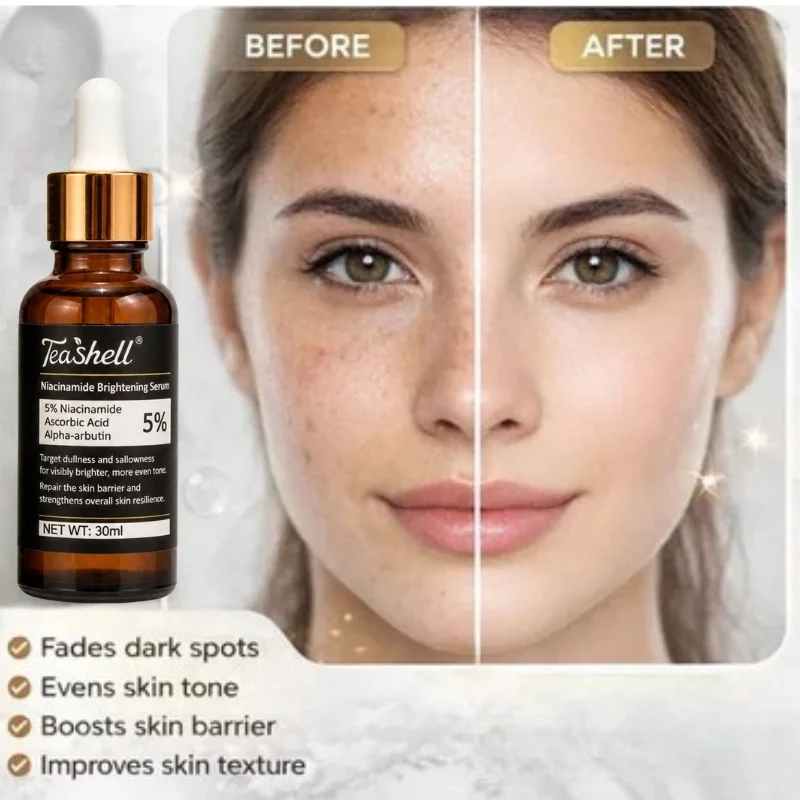 Teashell 5% Niacinamide Brightening Serum | Alpha Arbutin & Ascorbyl Acid | Dark Spot & Acne Mark Care | For All Skin Types | 30ml - Image 5