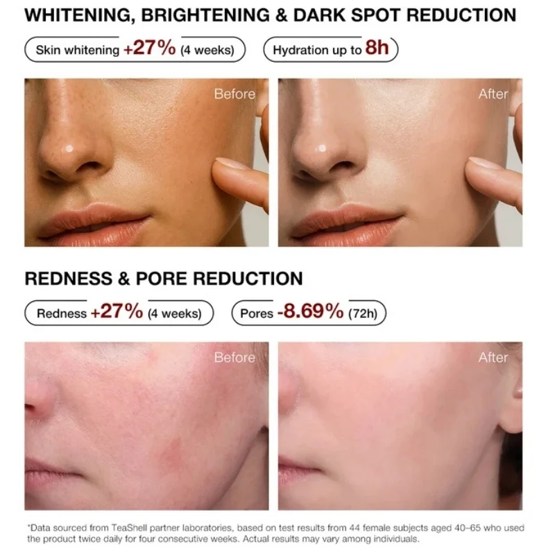 Teashell 5% Niacinamide Brightening Serum | Alpha Arbutin & Ascorbyl Acid | Dark Spot & Acne Mark Care | For All Skin Types | 30ml - Image 4