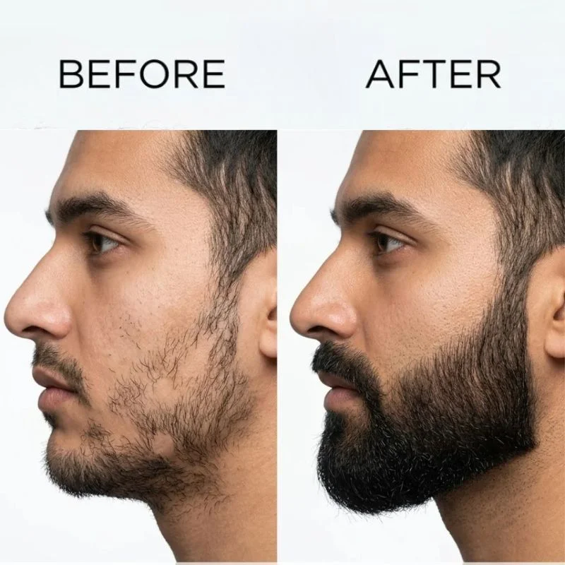 Dr. Alies Professional Beard Growth Oil | Natural Beard Care Oil for Patchy & Thin Beards | Moisturizing, Itch & Dandruff Care | 30ml - Image 3