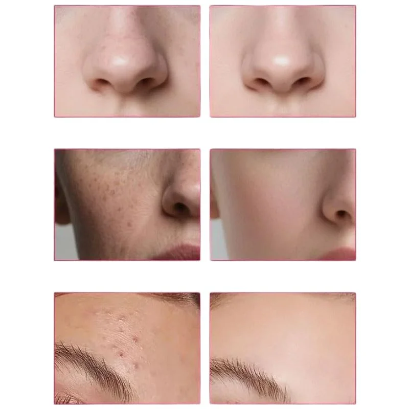 Arbutin 7% + Tranexamic Acid 4% Cream | Brightening Moisturizer for Dark Spots, Uneven Tone & Hydration | 50g - Image 6