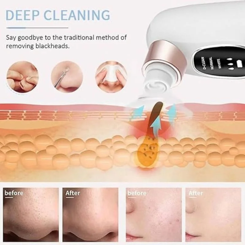 Electric Super Micro Bubble Beauty Blackhead Remover | Pore Vacuum Cleaner & Facial Deep Cleansing Device | USB Rechargeable Skin Care Tool - Image 5